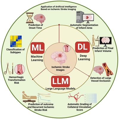 Artificial intelligence in ischemic stroke images: current applications and future directions